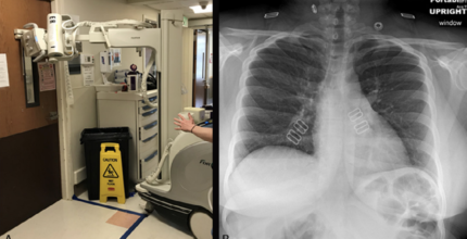 Imaging Equipment Playing Key Role In Battling Covid-19